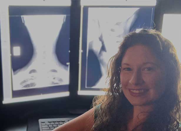 Chiropractic Radiologist in Milwaukee Stephanie Mussmann